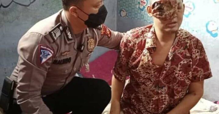 Tumor Ganas Hampir Menutup Semua Wajahnya, Polisi Bantu Carikan Pendonasi