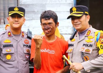 Peduli Warga, Kapolres Bengkalis Bantu Penderita Penyakit Kanker Kulit Berobat ke Rumah Sakit