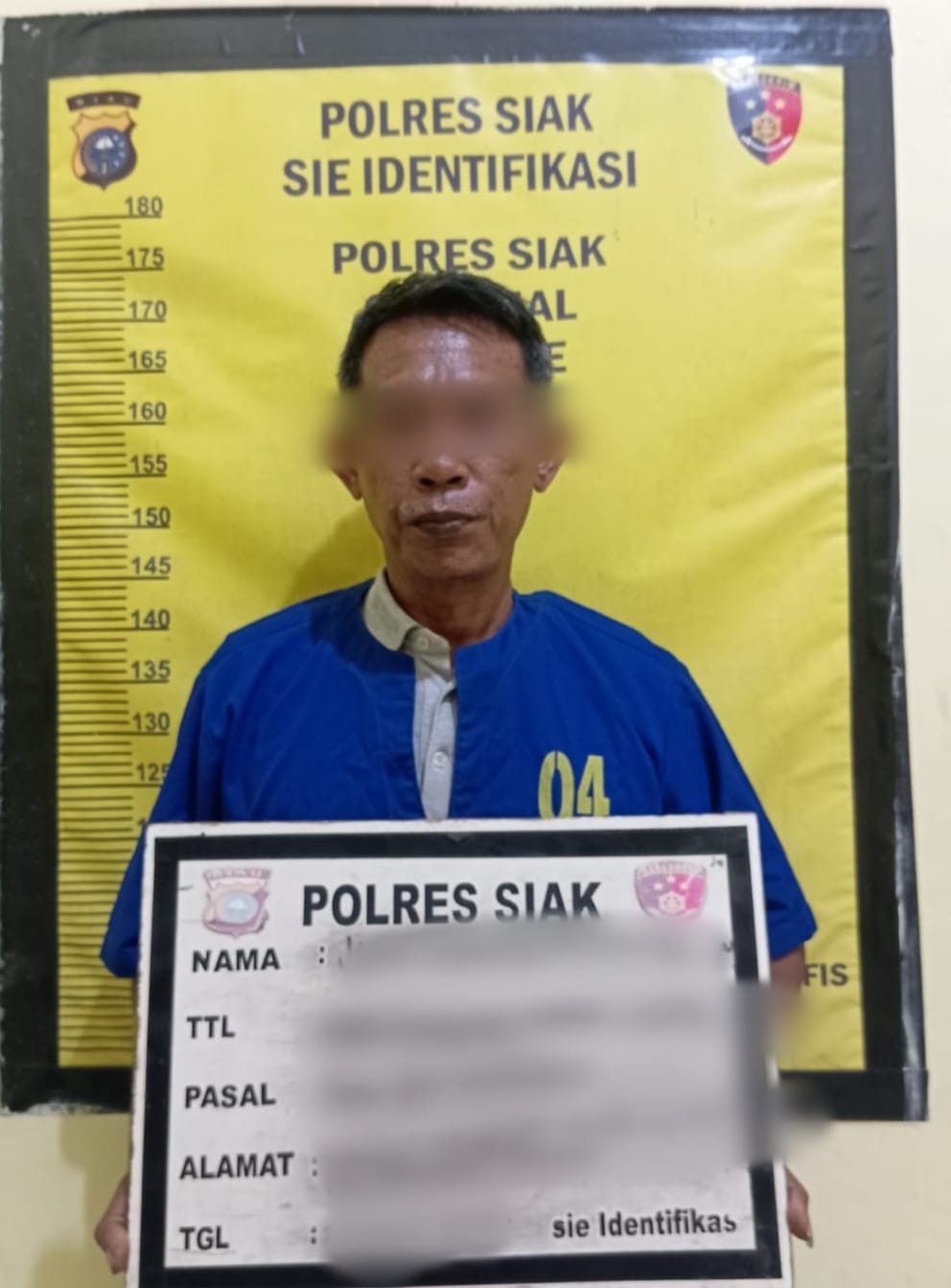 Dugaan Penganiayaan Ringan Di Lubuk Dalam, Seorang Ibu Rumah Tangga Laporkan Kejadian Ke Polisi